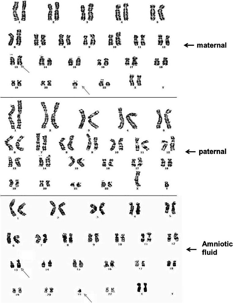 Fig. 3