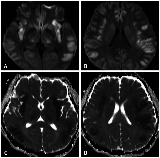 Fig. 10