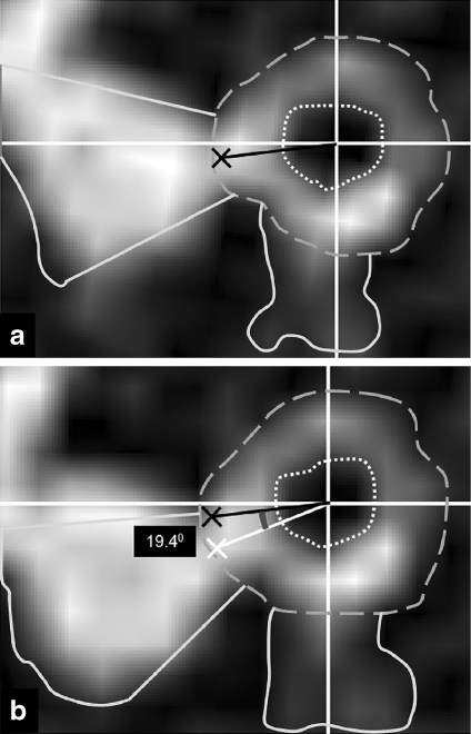 Fig 3