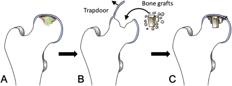 Figure 1