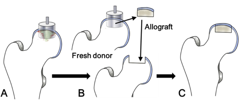 Figure 3