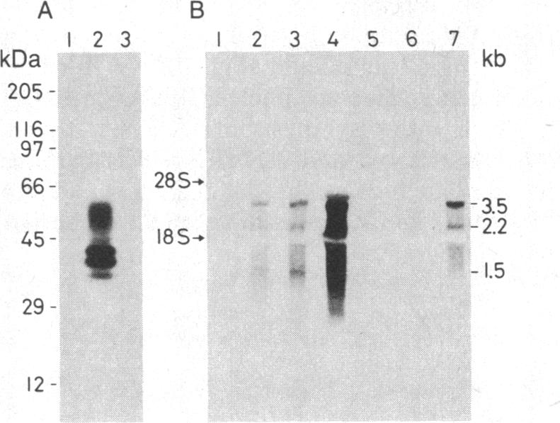 graphic file with name pnas00321-0208-a.jpg