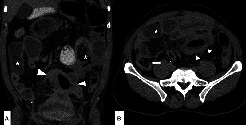 Fig. 8