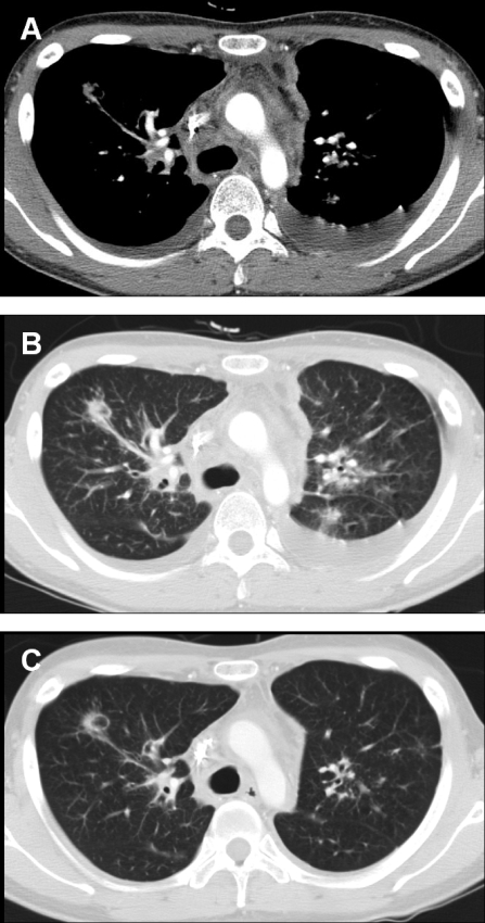 FIG. 1.