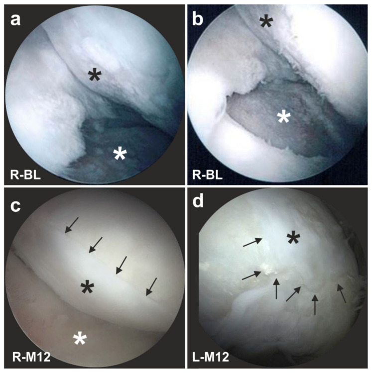 Figure 26