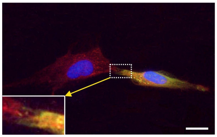 Figure 16