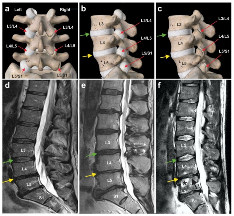 Figure 30