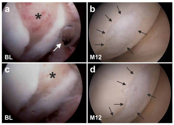 Figure 27