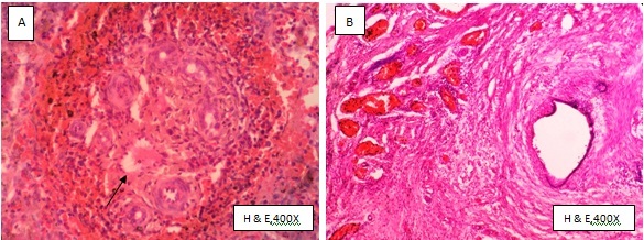 [Table/Fig-5]: