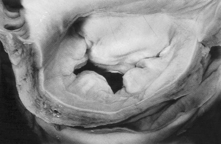 Figure 16