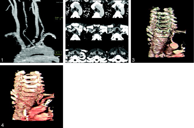 Fig 2.