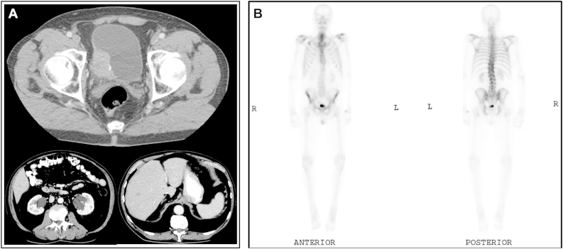 Figure 1