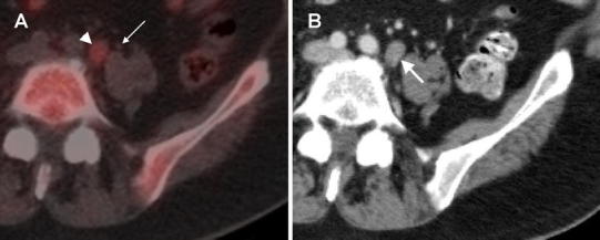 Fig. 3