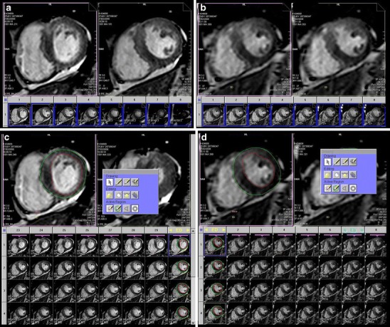 Fig. 1a–d