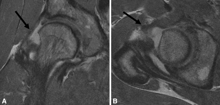 Fig. 10A–B