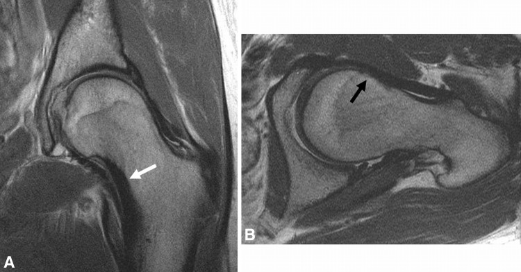 Fig. 8A–B