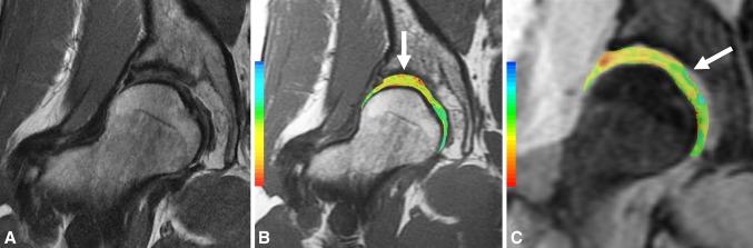 Fig. 4A–C