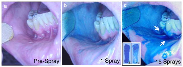 Fig. 3