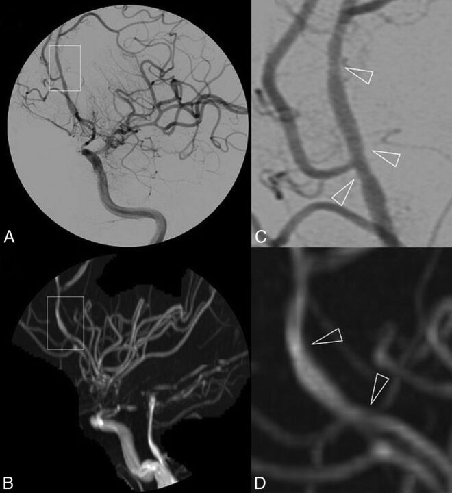 Fig 2.