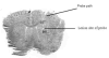 Fig.1