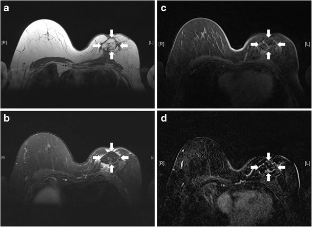 Fig. 25