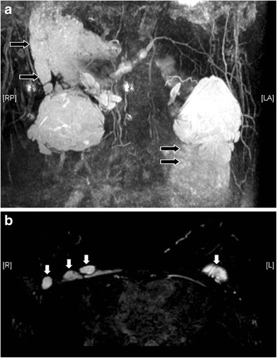 Fig. 14