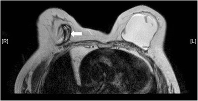 Fig. 15