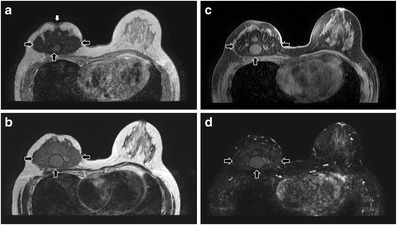 Fig. 23