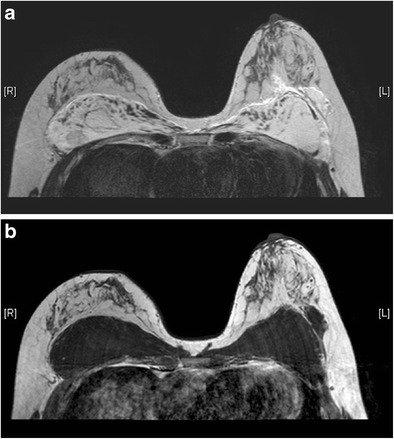 Fig. 17