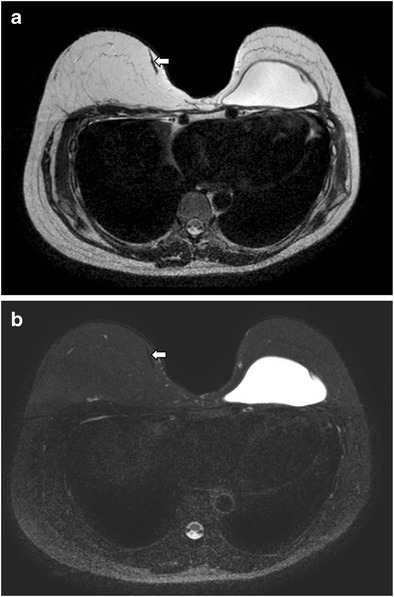 Fig. 24