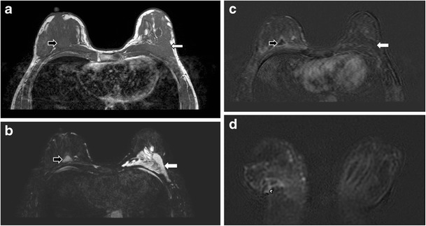 Fig. 21