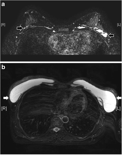 Fig. 20