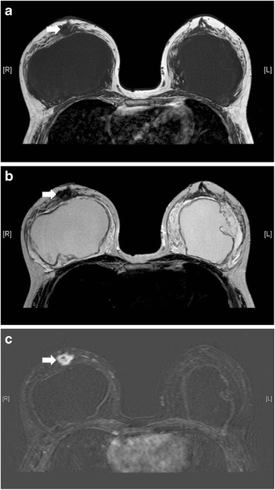 Fig. 26