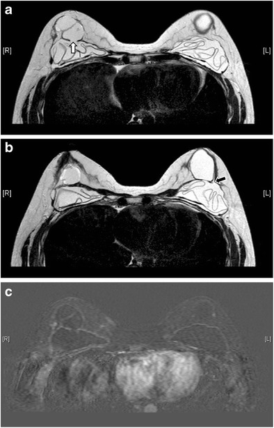 Fig. 12