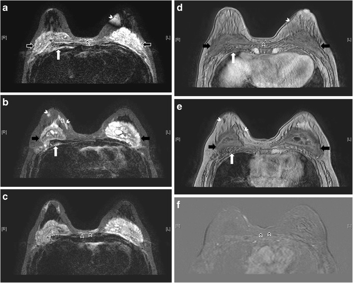 Fig. 22