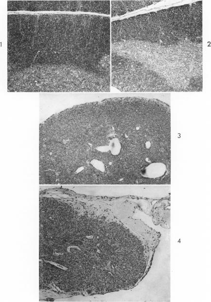 Fig. 1-4