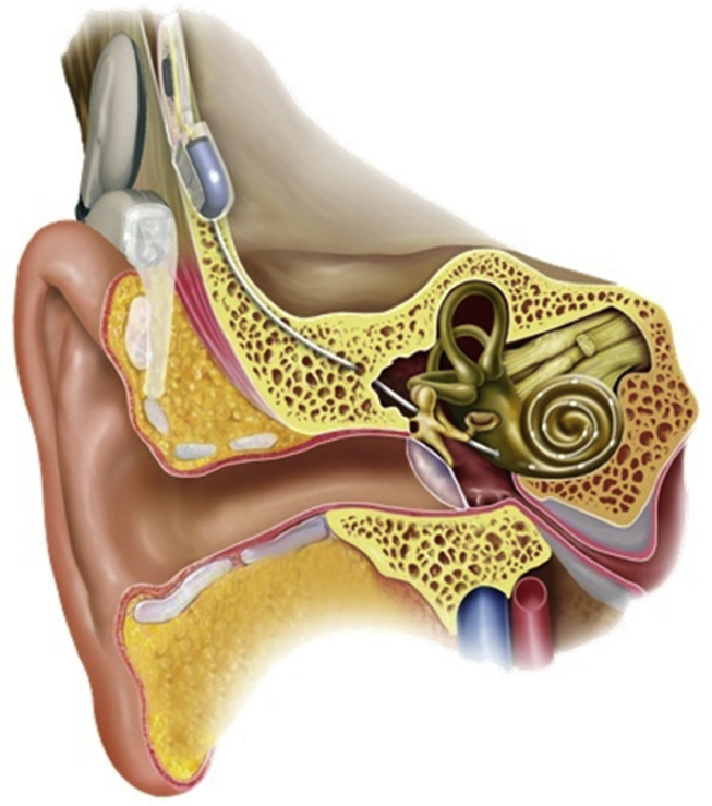 Fig. 1