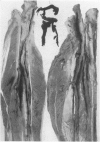 292-1