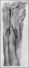 292-3