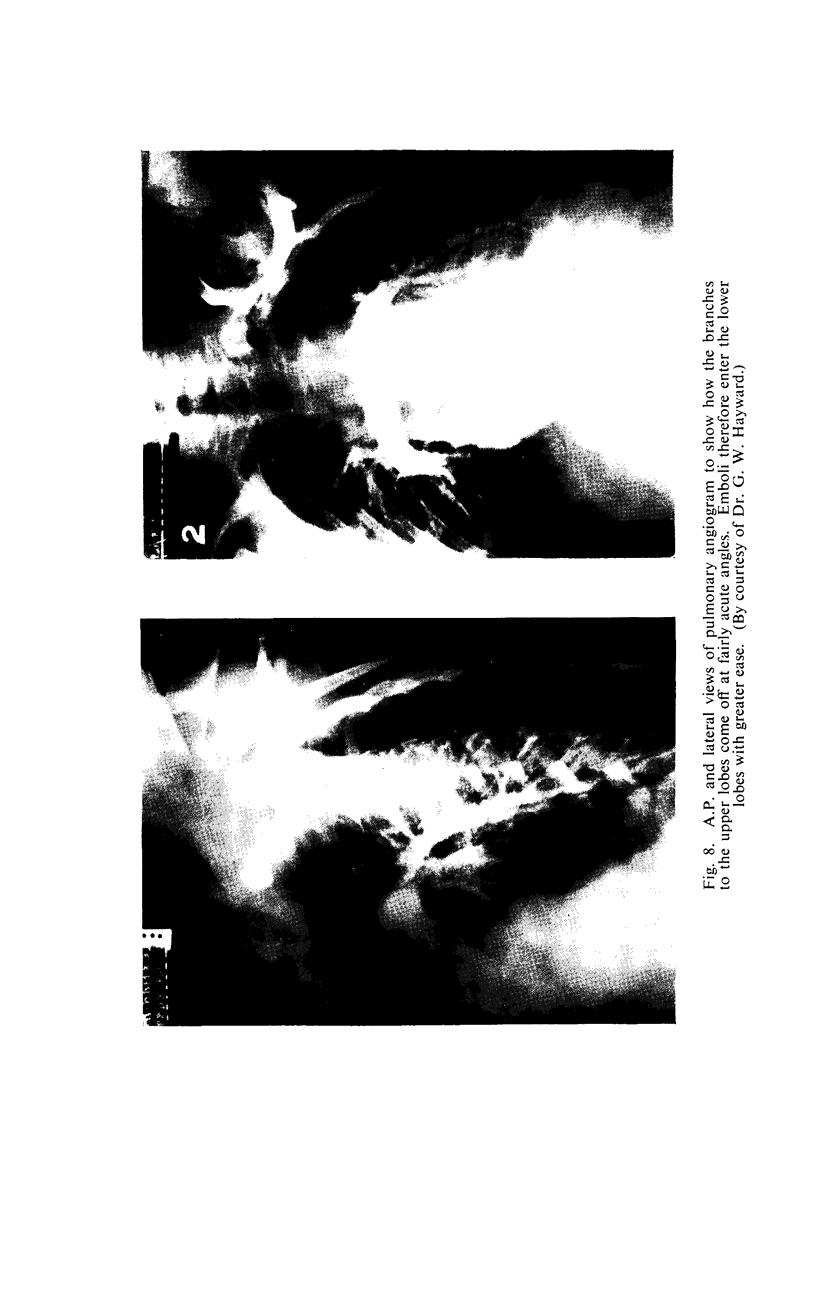 292-6