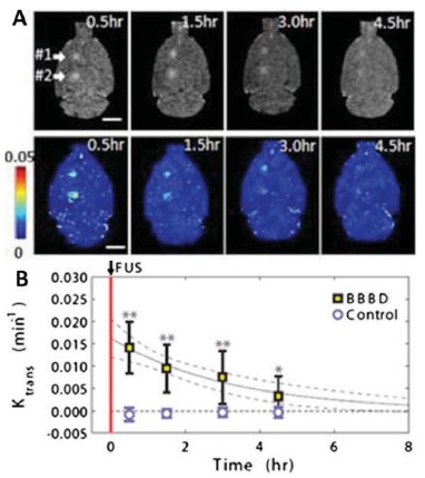 Fig. (2)