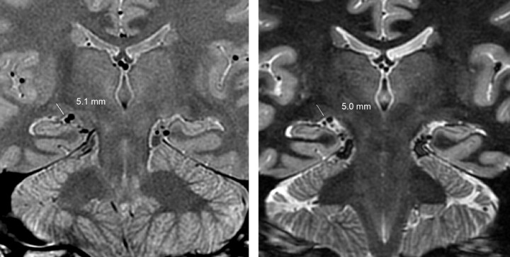 Fig 3.