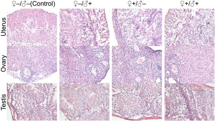 Figure 11