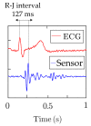 Figure 18