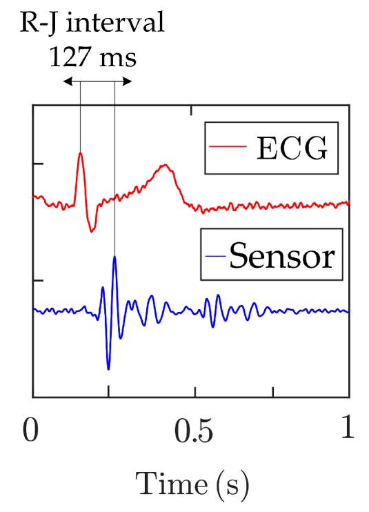 Figure 18