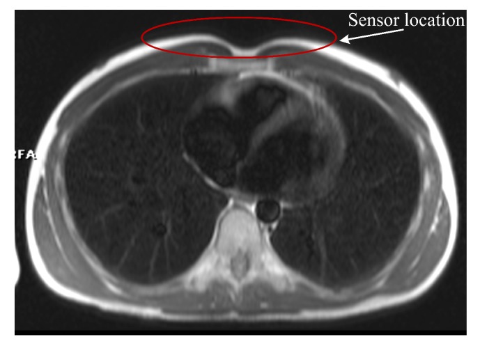 Figure 16