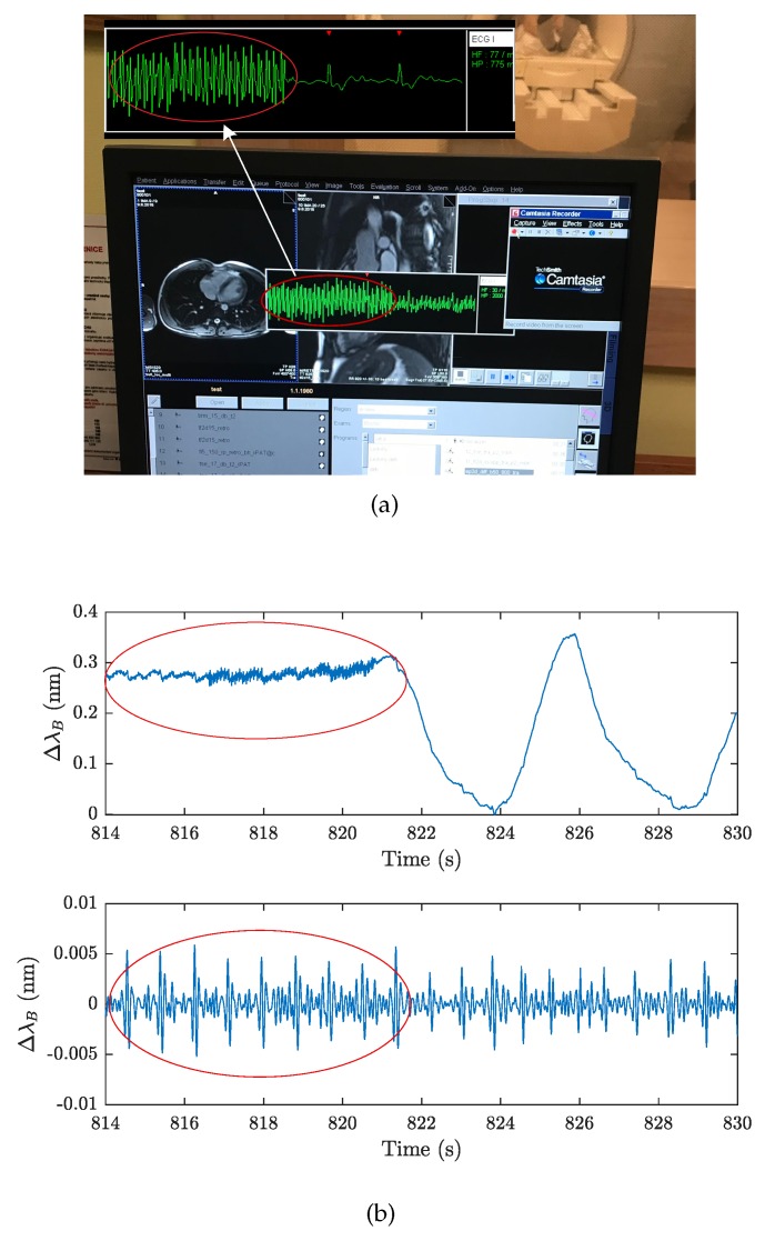 Figure 17