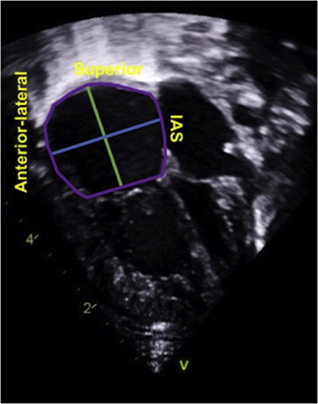 Figure 4