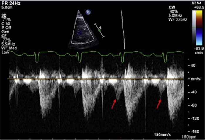 Figure 5