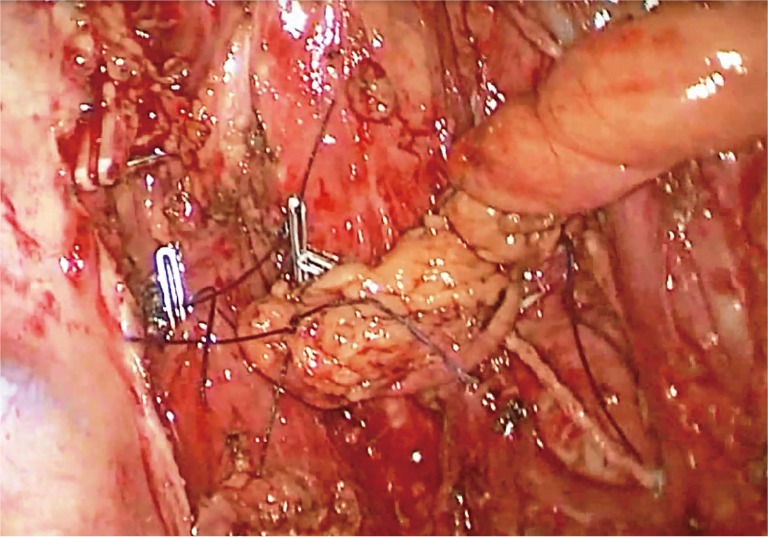 Figure 15